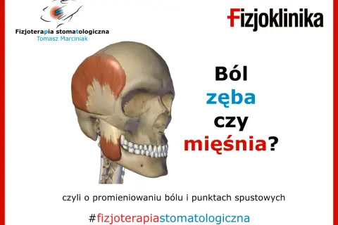Model czaszki z zaznaczonym mięśniem skroniowym i żuchwą. Pytanie: Ból zęba czy mięśnia? Dotyczy bólu wszystkich zębów i punktów spustowych.