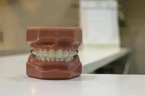 Model szczęki z zębami w aparacie lingwalnym.