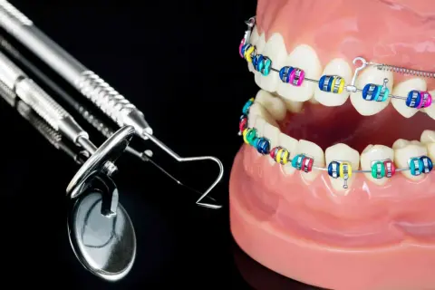 Model szczęki z kolorowym aparatem ortodontycznym i narzędziami dentystycznymi. Pomoc w leczeniu tyłozgryzu i ćwiczenia.
