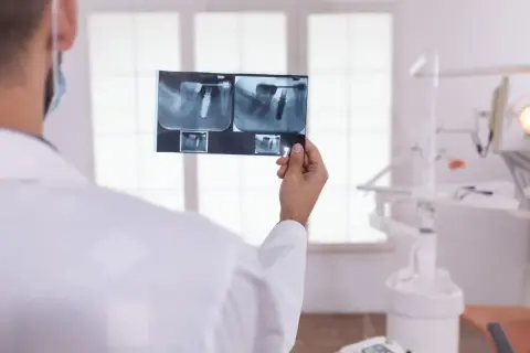 Dentysta analizuje RTG, by sprawdzić, ile korzeni ma ząb 7 górna. Widoczne implanty i korony.