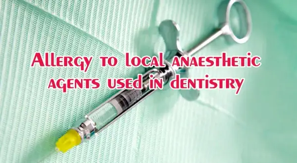 Objawy uczulenia na znieczulenie u dentysty – jak rozpoznać i zapobiec reakcji alergicznej