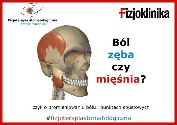 Model czaszki z zaznaczonym mięśniem skroniowym i żuchwą. Pytanie: Ból zęba czy mięśnia? Dotyczy bólu wszystkich zębów i punktów spustowych.