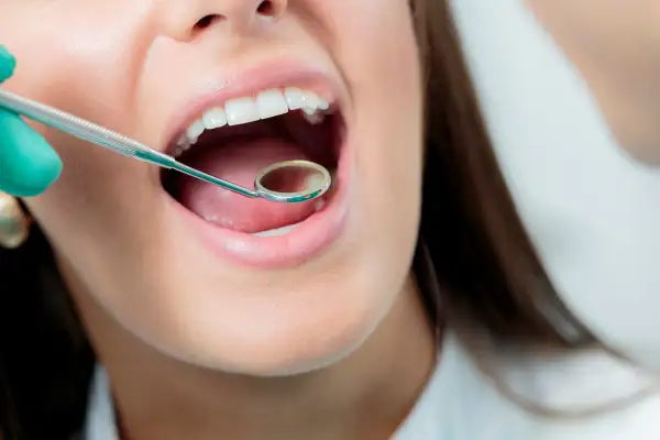 Usta kobiety otwarte, dentysta bada podniebienie. Różne rodzaje podniebienia są widoczne podczas badania.